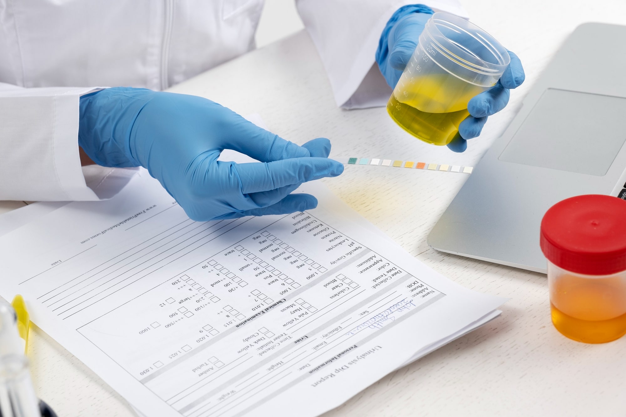 drug test in a physical dot exam